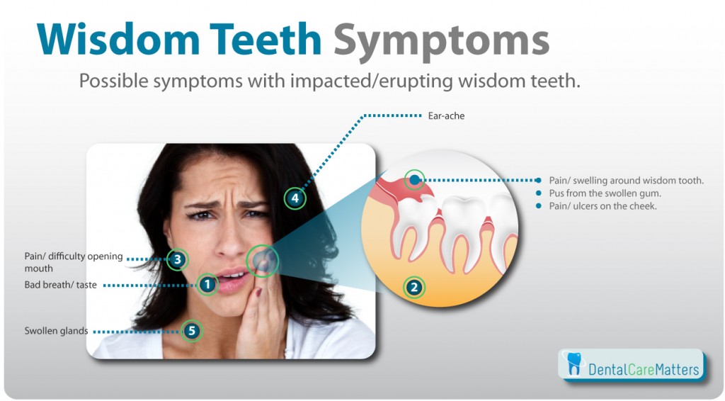 wisdom tooth symptoms