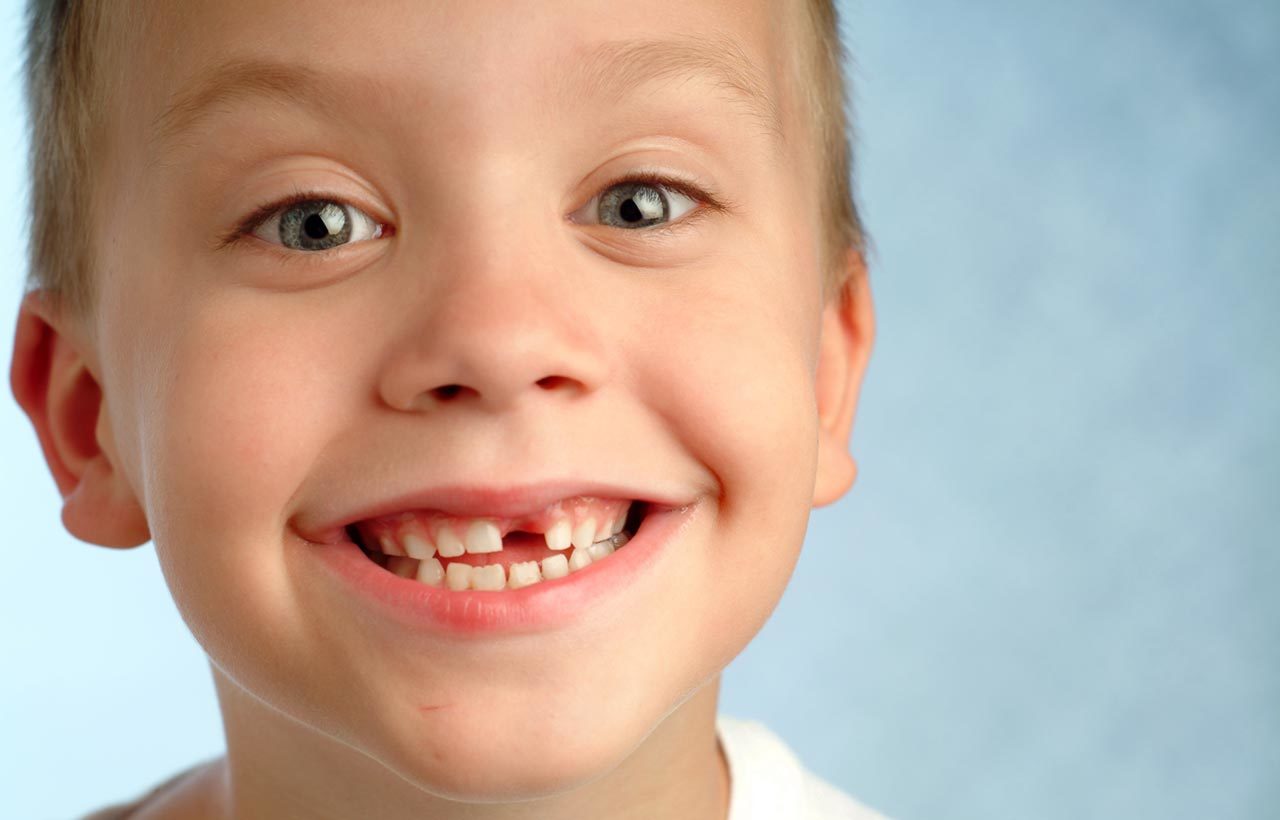 9 year old hasn't lost teeth